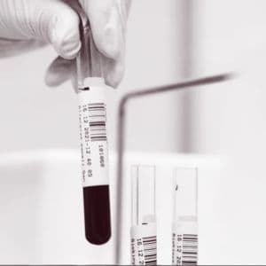 This promising anti-aging drugs just failed its human test